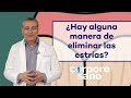 ¿Hay alguna manera de eliminar las estrías? | Corpore Sano