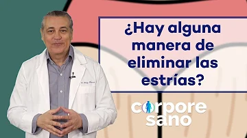 ¿Se pueden eliminar las estrías?