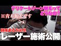 【メンズ脱毛】気になる下半身「Oライン（肛門周囲）」は痛いのか？
