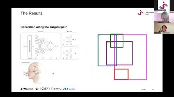 Live image - based neurosurgical guidance and roadmap generation using unsupervised embedding