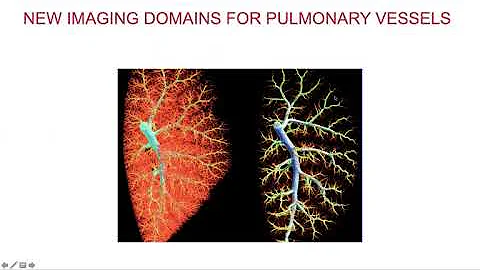 APHEC presentation - The future of PAH by Prof. Dr...