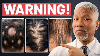 5 Hormone Imbalances That Could Be Causing Your Hair Loss