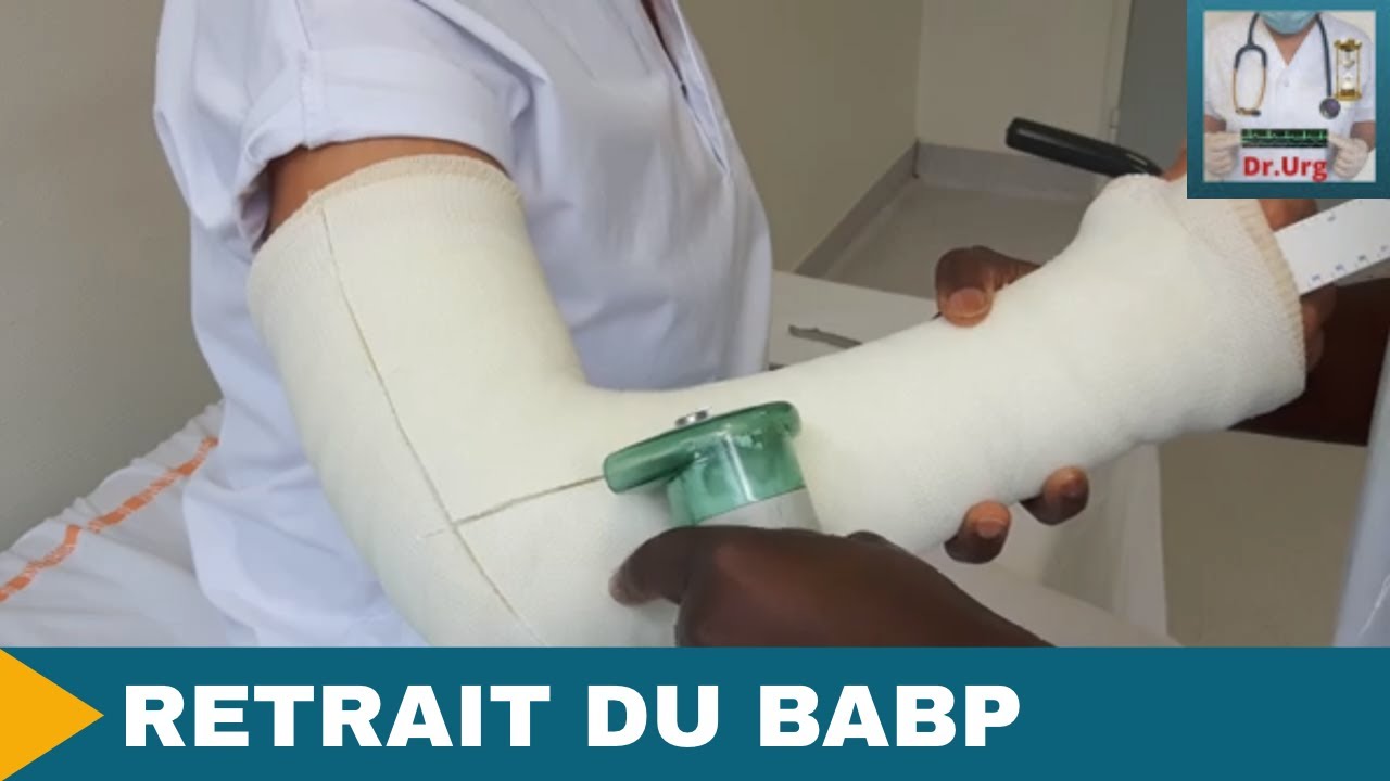 ENLEVER UN PLATRE: LE BABP 