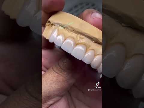 عدسات ايماكس