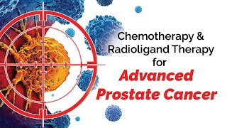 Chemotherapy and Radioligand Therapy for Advanced Prostate Cancer
