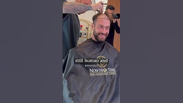 Chris Bumstead is Balding and decides to go for a hair transplant... 😲 😵#bodybuilding #shorts