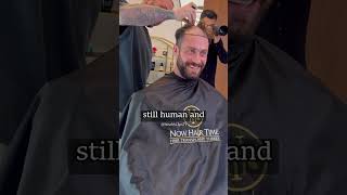 Chris Bumstead is Balding and decides to go for a hair transplant... 😲 😵#bodybuilding #shorts