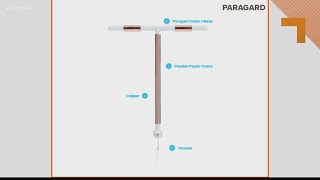 What you should know about the IUD Paragard