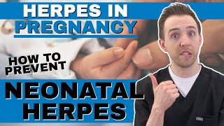 Genital Herpes Simplex Virus In Pregnancy (HSV) (Neonatal Herpes Simplex Infection)