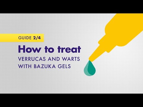How to treat verrucas and warts with Bazuka gels