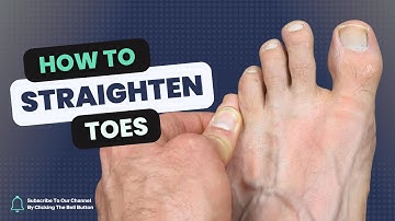 Hoe je een gedraaide teen rechtzet