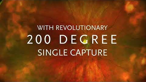 Optos - SilverStone Introduction