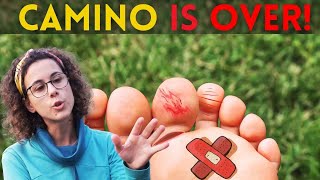 85% of blisters can be prevented before the Camino, five expert hacks!