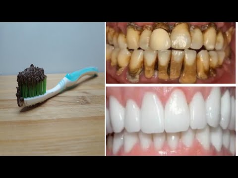 HOW TO HAVE NATURAL WHITE TEETH IN 3 MINUTES ( WORKS 100% )