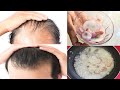 How to Grow Long Thicken Hair with Rice Water and Onion  | World&#39;s Best Remedy for Hair Growth