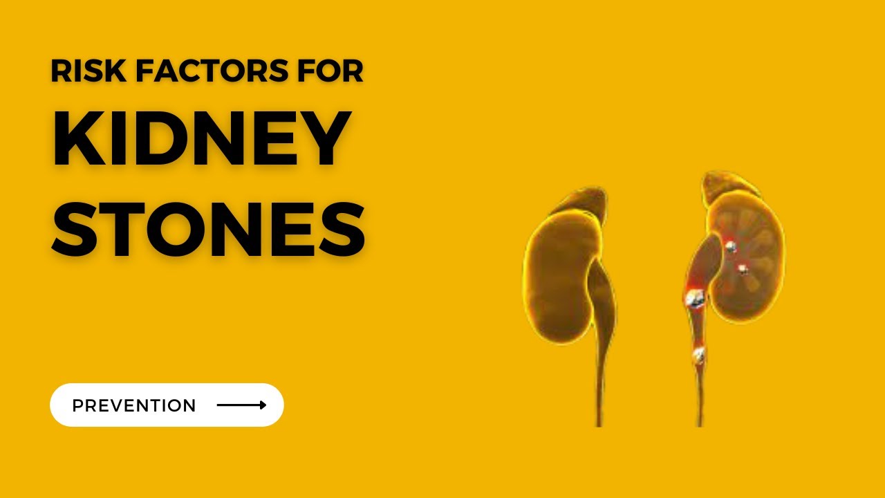 Risk factors for kidney stones and prevention YouTube