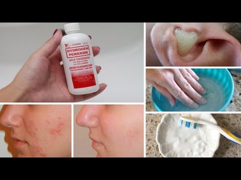 7 Surprising Uses For Hydrogen Peroxide