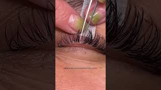 Removing An Ingrown Eyelash