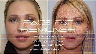 ★ Instant Face Fat Removal Subliminal ★ Buccal Fat and Double Chin Remover | Super Model Looks |