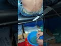 Pleural Effusion