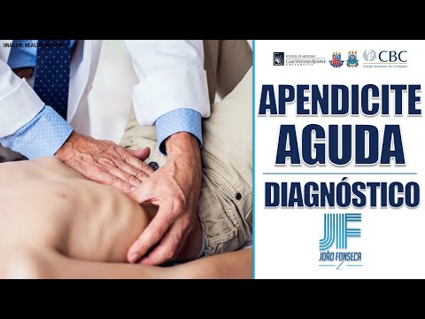 APENDICITE AGUDA (Parte 2): Diagnóstico 👨🏽‍⚕‍🚑 Joao Fonseca (Cirurgia Geral)