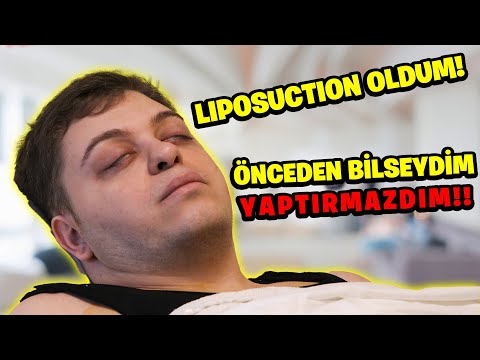 LIPOSUCTION OLDUM! SANCILI SÜREÇ! | Gıybet Mi? #115