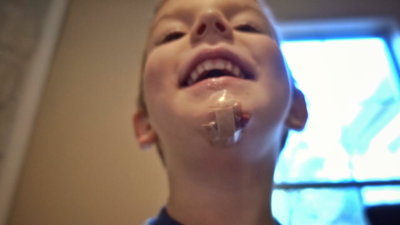 vlogs in spanish Does This Need Stitches???