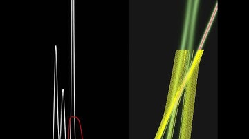Three-Soliton Collision According to Bohmian Quantum Mechanics