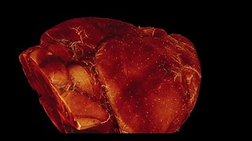 3D imaging of mouse brain using a tiling light sheet microscope