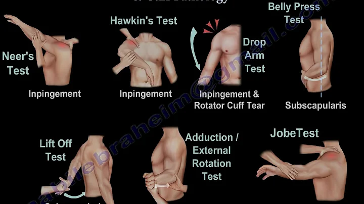 Shoulder Examination / Subacromial, Cuff - Everything You Need To Know - Dr. Nabil Ebraheim