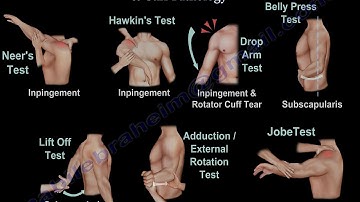 Shoulder Examination / Subacromial, Cuff - Everything You Need To Know - Dr. Nabil Ebraheim