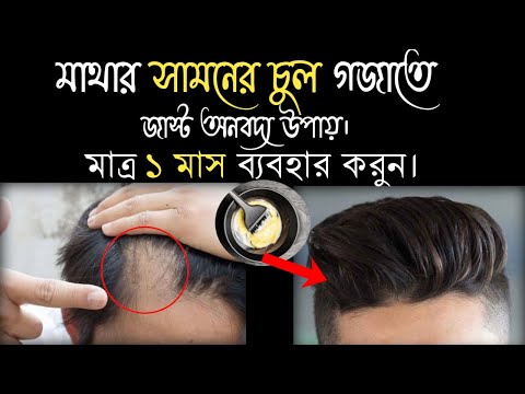 ভিডিও: লম্বা চুল গজানোর W টি উপায় যদি আপনি একজন কালো মহিলা হন