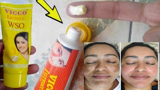 ViccoTurmeric cream|Remove Acne|Pimples|Pigmentation Dark Spots  From Face|complete Reviewहिन्दी मैं screenshot 2