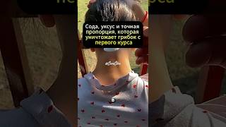 Формула чистоты: как сода и уксус победили грибок там, где мази не справлялись #здоровье