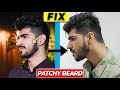 BEARD GROWTH ROUTINE | How To FIX Patchy Beard Naturally | Home remedies | Beard Hacks