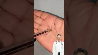 Do You Have An M On The Palm Of Your Hand? Then You Have Been Chosen