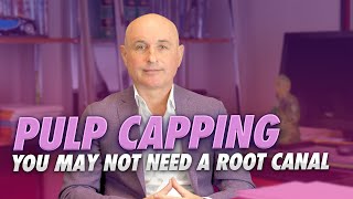 Pulp Capping - You May Not Need the Root Canal