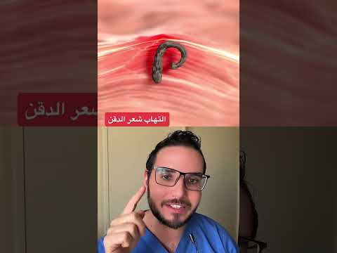التهاب بوصيلات اشلعر بعد الحلاقه 