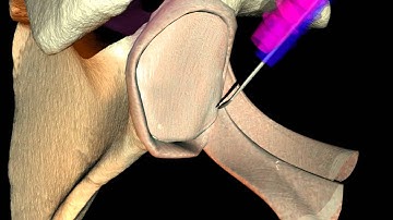 Soft Tissue manipulation using cloth simulation