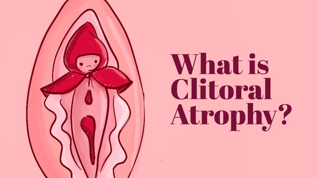 What is Clitoral Atrophy picture picture