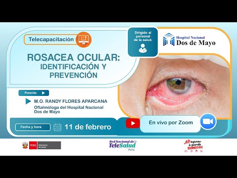 Vídeo: Rosácea Ocular: Síntomas, Gotas Para Los Ojos, Desencadenantes, Tratamiento Y Más