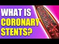 What you need to know about coronary stents