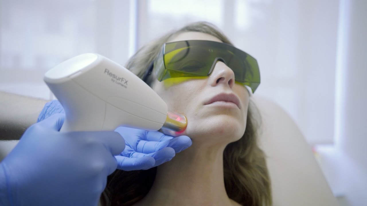 Resurfacing cutaneo con Laser