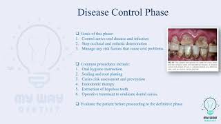 Dental Treatment Planning and Phases Summarized