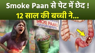 Bengaluru Girl का Smoke Paan खाने से Stomach Hole, Liquid Nitrogen Side Effects In Hindi | Boldsky