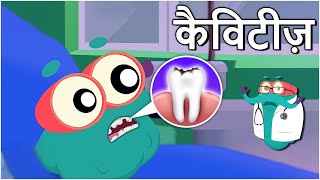 कैविटीज़ | दांतों में कीड़े | Cavities In Hindi | Dr.Binocs Show | Educational Videos For Kids