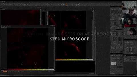 Finnish Advanced Light Microscopy Node provides remote access to STED microscope