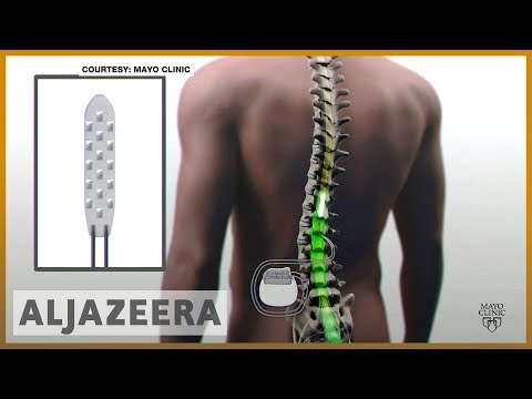 🇺🇸 New implant gives hope to the paralyzed | Al Jazeera English