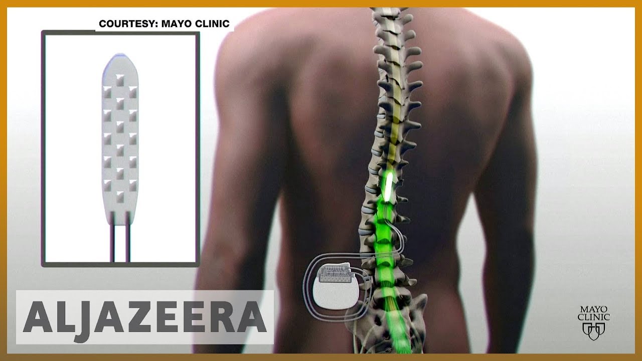 🇺🇸 زرعة جديدة تمنح الأمل للمصابين بالشلل | الجزيرة الإنجليزية