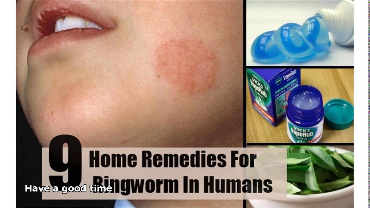 roundworm treatment for humans